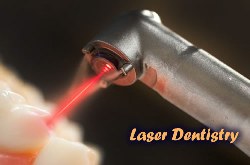 nhung ung dung cua laser trong dieu tri nha khoa